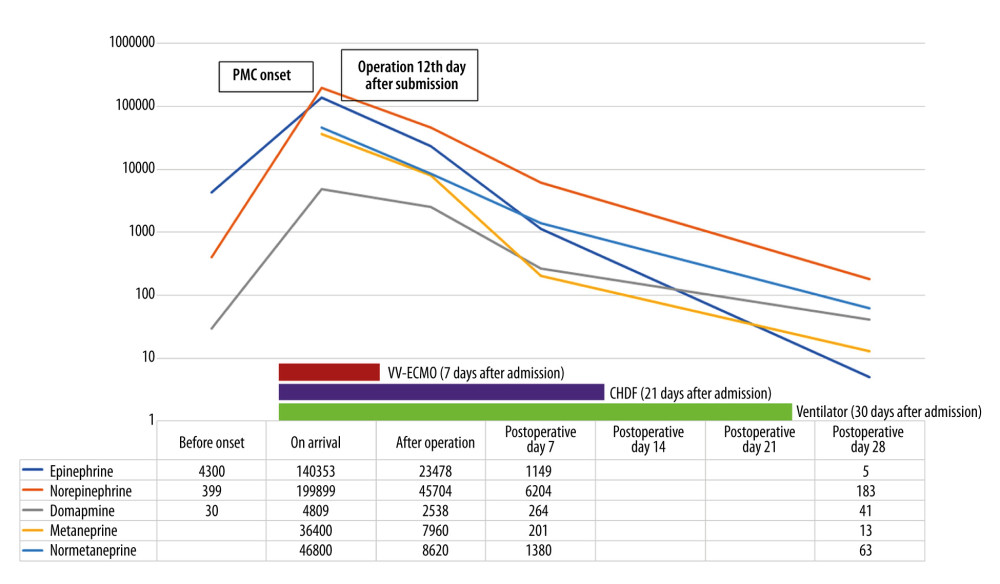 Timeline and summary of this caseThis timeline shows both the acute-phase treatment course and the levels of catecholamines and their metabolites until 4 weeks after admission. Catecholamines and their metabolite dramatically decreased after operation. The patient was weaned from CHDF on hospital day 21 and was finally weaned from artificial ventilation on hospital day 30.