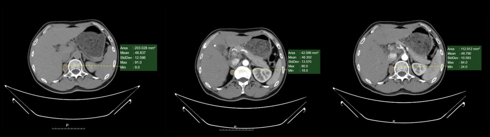 Preoperative computed tomography images.