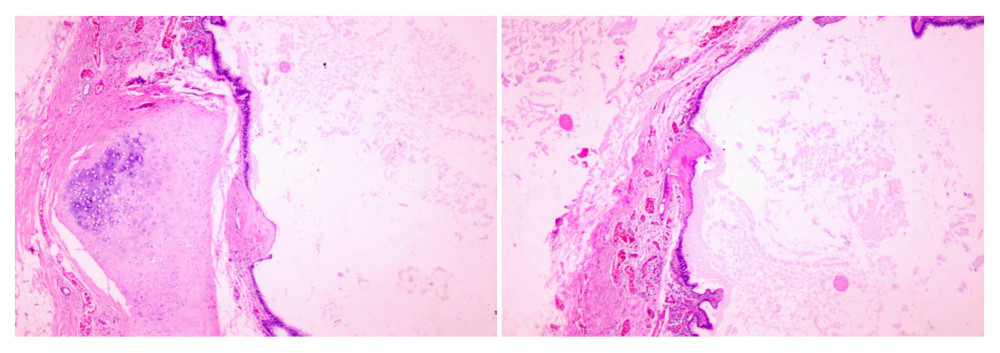 Postoperative pathological images.