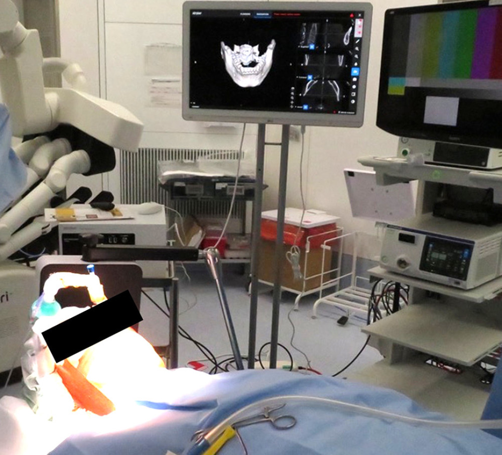 Field generator and navigation system in the operating room.