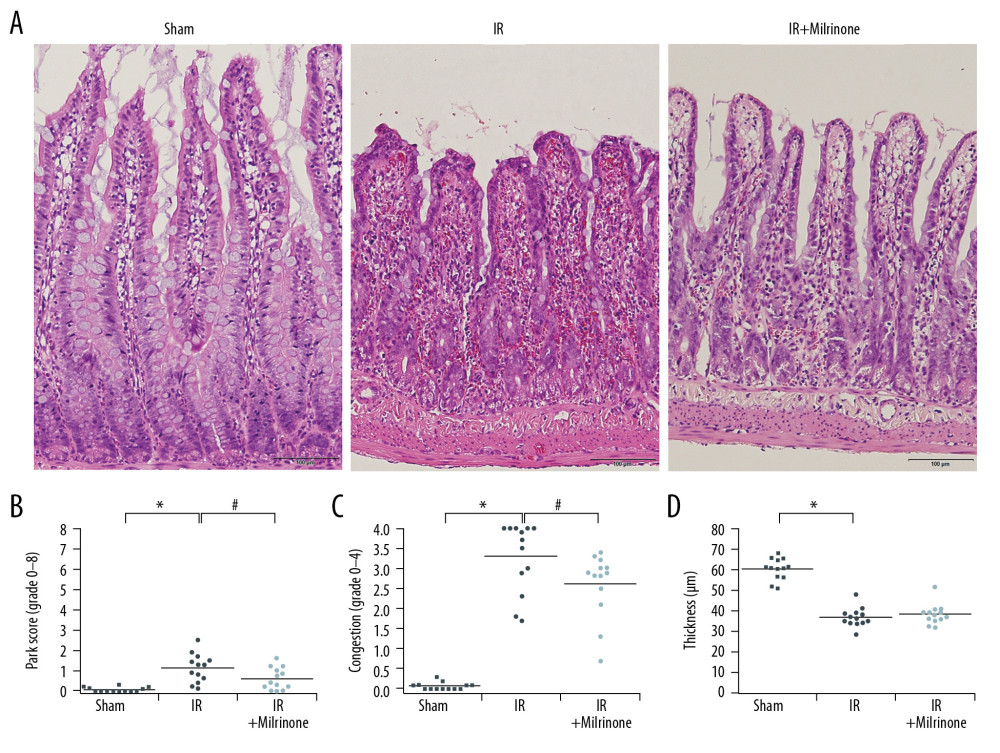 Histological changes of small intestine related to hepatic ischemia-reperfusion (IR) injury: In the IR group, the ilea showed severe congestion in the lamina propria with shortened villi. In the IR+milrinone group ilea, the villus architecture was preserved, and the congestion was decreased (A). The Park and congestion scores in the villi of the IR group were significantly higher than those of the sham group. These villus scores of the IR+milrinone group were significantly decreased as compared with those of the IR group. The IR group villi were lower than those of the sham group (B–D). * Significantly (P<0.001) different from the sham group. # Significantly (P<0.05) different from the IR group.
