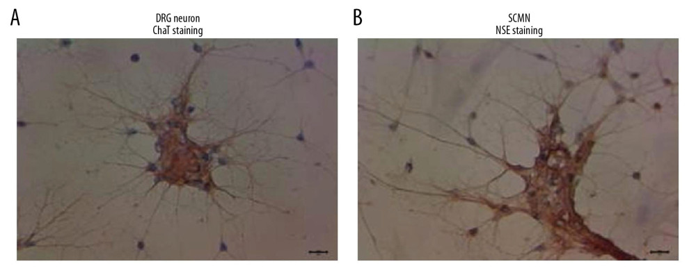 Identification of DRG cells (A) and SCMN cells (B) using immunocytochemistry assay. The DRG cells were identified by detecting the ChAT molecule. SCMN cells were identified by detecting the NSE molecule.