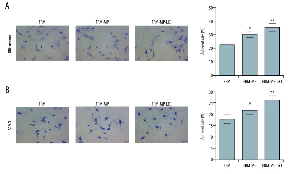 Effects of FRM-MP on the adherent ability of neurons determined using toluidine blue staining. (A) Evaluation of the effect of FRM-MP on the adherent ability of DRG neurons. (B) Evaluation of th effect of FRM-MP on the adherent ability of SCMN neurons. The blue-stained cells represent the adherent cells. * p<0.05 vs. FRM group. # p<0.05 vs. FRM-MP group.