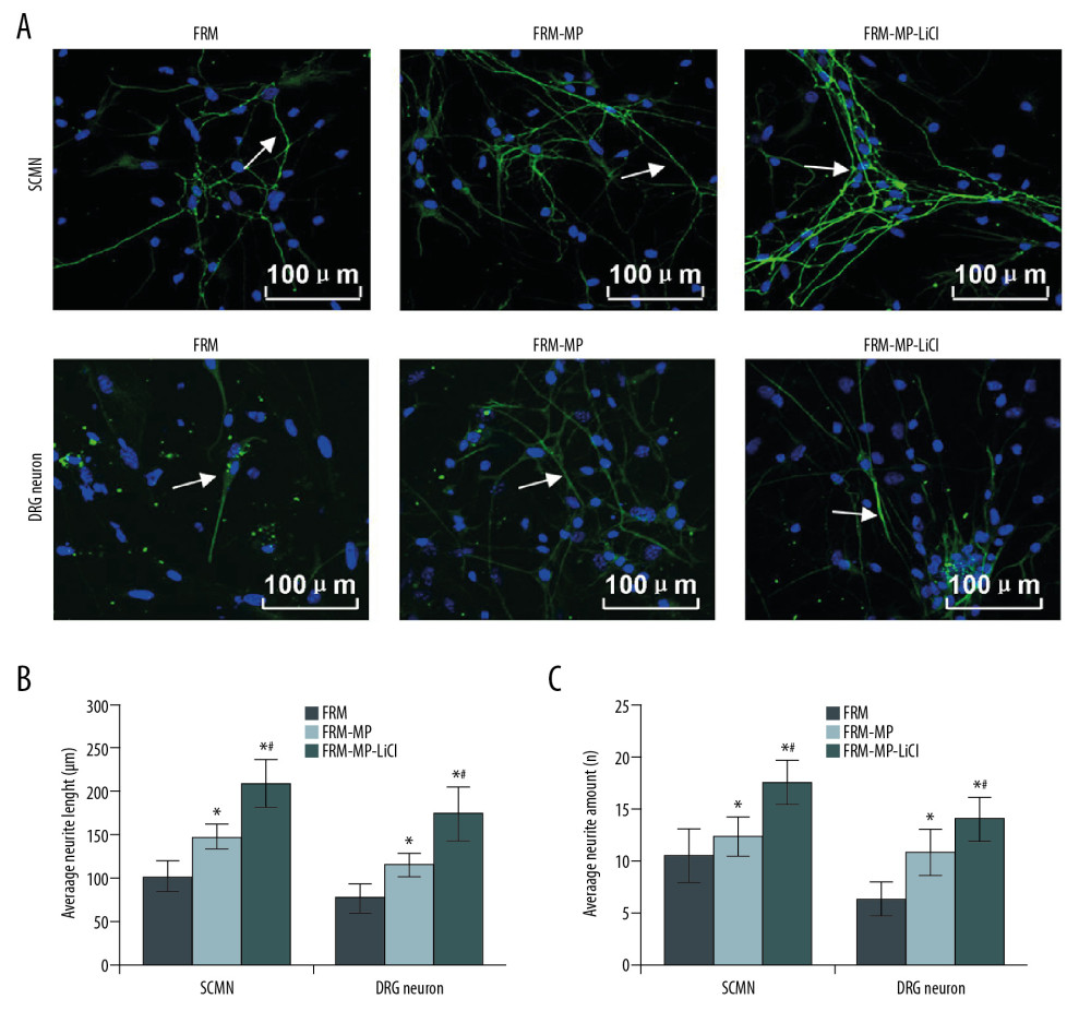 Measurement of neurite extension using immunofluorescence assay. (A) Measurement of neurite extension, including neurite length, amounts, and branches in SCMN neurons and DRG neurons. (B) Statistical analysis of the length of neurite in SCMN neurons and DRG neurons. (C) Statistical analysis of amount of neurite in both SCMN neurons and DRG neurons. The white arrows represent the neurite. The scale bars were added in the images. *p<0.05 vs. FRM group. # p<0.05 vs. FRM-MP group.