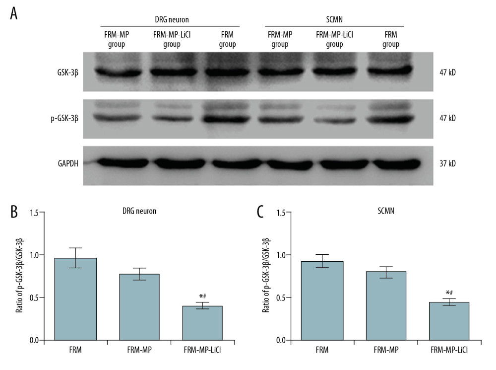 Determination of phosphorylated-GSK-3β (p-GSK-3β)/GSK-3β signaling pathway in neurons (DRG neurons and SCMN neurons) using Western blot assay. (A) Western blot images for GSK-3β and p-GSK-3β molecule expression in DRG neurons and SCMN neurons. (B) Statistical analysis of the ratio of p-GSK-3β/GSK-3β in DRG neurons. (C) Statistical analysis of the ratio of p-GSK-3β/GSK-3β in SCNM neurons. * p<0.05 vs. FRM group. # p<0.05 vs. FRM-MP group.