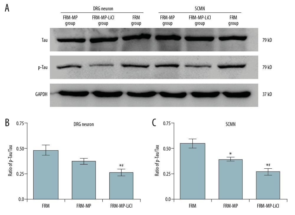 Examination for Tau and phosphorylated-Tau (p-Tau) expression in neurons (DRG neurons and SCMN neurons) using Western blot assay. (A) Western blot images for Tau and p-Tau molecule expression in DRG neurons and SCMN neurons. (B) Statistical analysis of ratio of p-GSK-3β/GSK-3β in DRG neurons. (C) Statistical analysis of ratio of p-GSK-3β/GSK-3β in SCNM neurons. * p<0.05 vs. FRM group. # p<0.05 vs. FRM-MP group.