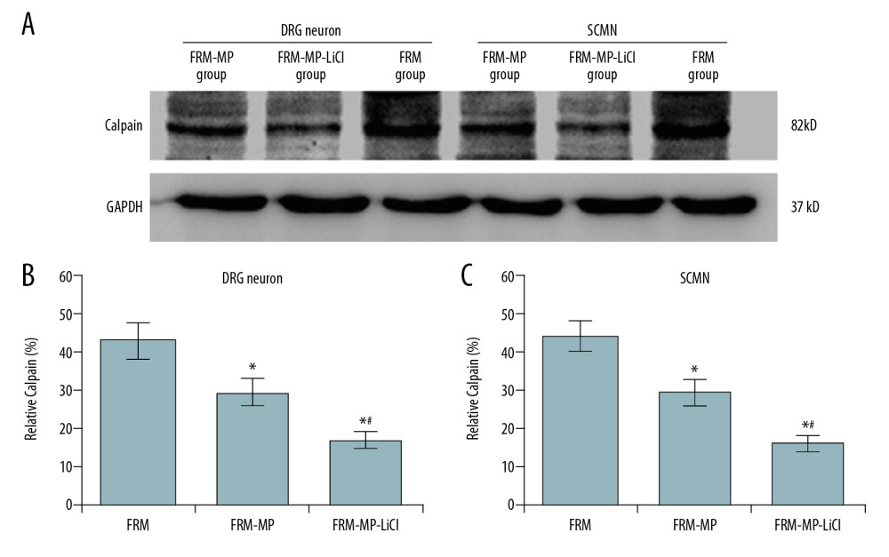 Effects of FRM-MP or FRM-MP-LiCl on calpain expression in neurons (DRG neurons and SCMN neurons) using Western blot assay. (A) Western blot images for the calpain expression. (B) Statistical analysis of calpain expression in DRG neurons. (C) Statistical analysis of calpain expression in SCMN neurons. * p<0.05 vs. FRM group. # p<0.05 vs. FRM-MP group.