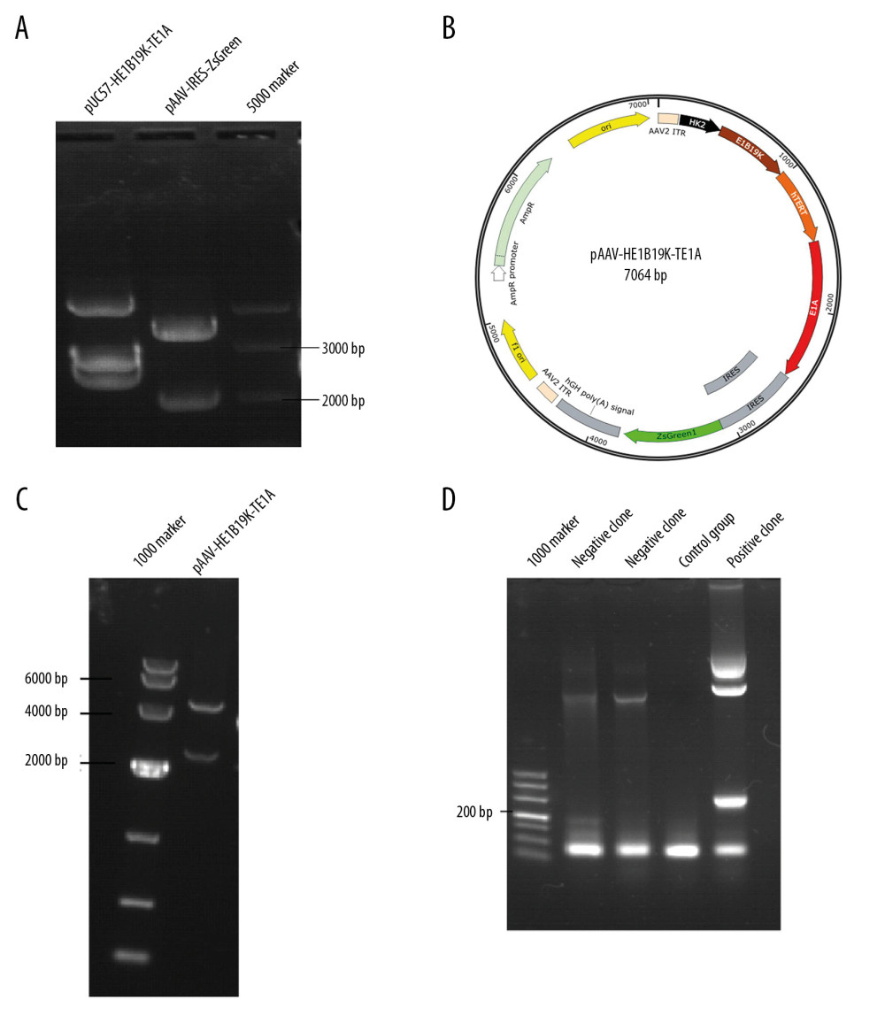 Synthesis of the new transgene plasmid pAAV-HE1B19K-TE1A. (A) Restriction digestion of pUC57-HE1B19K-TE1A and pAAV-IRES-ZsGreen with Mlu1 and BamH1. (B) The structure of the pAAV-HE1B19K-TE1A. (C) Positive clones were verified by restriction digestion. (D) Positive clones were verified by PCR assay.