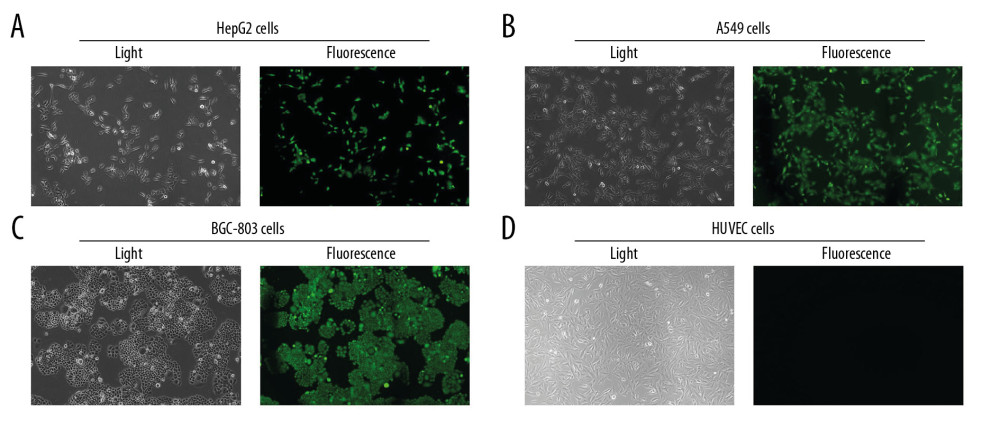 Determination for pAAV-HE1B19K-TE1A transfection in tumor cells. ZsGreen expression was observed in HepG2 (A), A549 (B), and BGC-803 (C), but not in HUVEC cells (D).