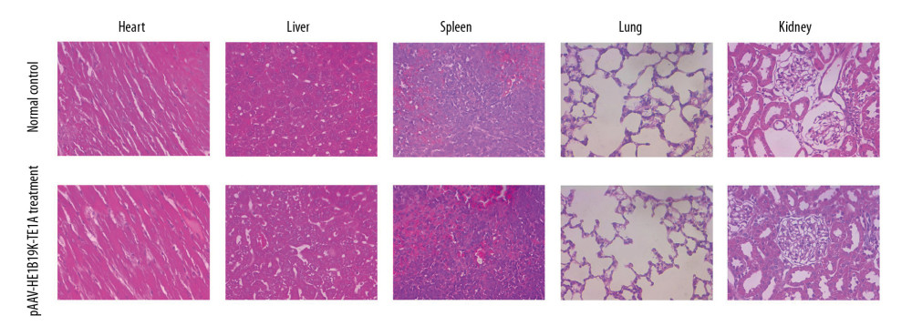 HE staining for analyzing pathological changes of vital organs of mice after pAAV-HE1B19K-TE1A injection and in the vital organs of normal mice. For the pAAV-HE1B19K-TE1A-injected mice, at 2 weeks after injection, the tissues (heart, liver, spleen, lung, and kidney) were collected for toxicity evaluation. Magnification, 400×.