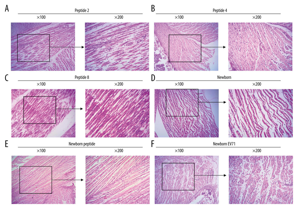 Peptide injections ameliorate inflammation. Hematoxylin and eosin staining of skeletal muscle tissues in the (A) Peptide 2, (B) Peptide 4, (C) Peptide 8, (D) Newborn, (E) Newborn peptide, and (F) Newborn EV71 groups. EV71 – enterovirus 71.