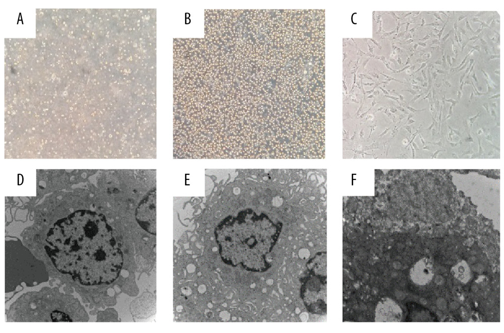 AFSCs in vitro expansion in pure amniotic fluid. (A) AFSCs in freshly-collected amniotic fluid (40×). (B) AFSCs in vitro cultured in pure amniotic fluid for 30 min (40×). (C) AFSCs cultured for 48 h in DMEM medium (20% serum) (40×). (D) Ultrastructure of AFSCs in freshly-collected amniotic fluid. (E) Ultrastructure of AFSCs after cultured in pure amniotic fluid. (F) Autophagosomes were observed in the cytoplasm when the expanded cells covered over 80% of the culture surface.