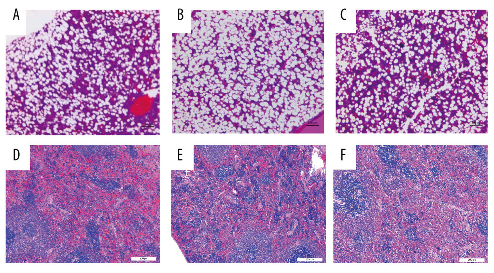 Histopathologic changes in bone marrow and splenic hematopoietic tissue after amniotic fluid transplantation. (A) Bone marrow from a normal healthy animal. (B) Bone marrow from an aplastic anemia rat; the hematopoietic cells significantly decreased compared to normal healthy animal. (C) Bone marrow from an aplastic anemia rat post amniotic fluid transplantation. The number of hematopoietic cells was very similar to that in healthy animals. (D) Splenic hematopoietic tissue from a normal healthy animal. (E) Splenic hematopoietic tissue from an aplastic anemia animal; compensatory extramedullary hematopoiesis was active. (F) Splenic hematopoietic tissue from an aplastic anemia rat after amniotic fluid transplantation; there was no obvious extramedullary hematopoiesis.