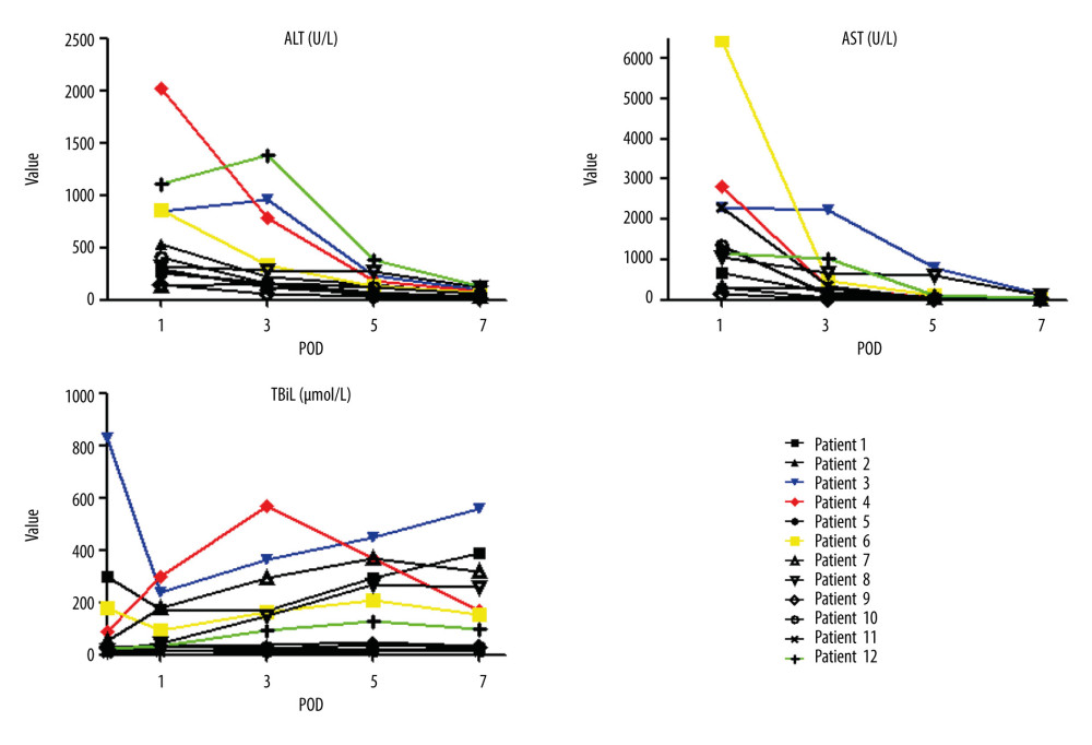 Recovery of liver function in the first week after liver transplantation, including alanine transaminase (ALT), aspartate aminotransferase (AST), and total bilirubin (TBIL) value variation. The colored lines represent 4 of 12 recipients with the highest ALT values.