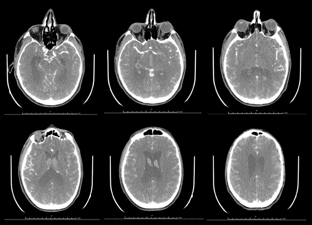 Head CT scan with contrast used in the scenario.