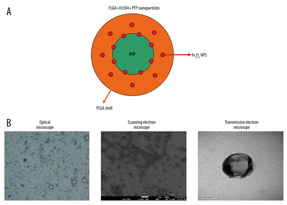 Morphology and structure of PLGA+Fe3O4+PFP nanoparticles (n=6). (A) Schematic illustration of structure of PLGA+Fe3O4+PFP nanoparticles. (B) Morphology and structure of PLGA+Fe3O4+PFP nanoparticles. Left: Optical microscope image (magnification, ×600); Middle: Scanning electron microscope image (magnification, ×1000); Right: Transmission electron microscope image (the scale represented 100 nm). Microsoft Office PowerPoint 2010 (Redmond, WA, USA) was used to create images.