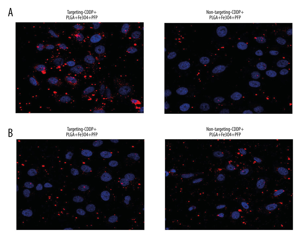 Targeting CDDP delivery efficacy of PLGA+Fe3O4+PFP nanoparticles into HNE1 cells (A) and HepG2 cells (B). The red-stained cells were defined as CDDP targeting HNE1 cells or HepG2 cells. Microsoft Office PowerPoint 2010 (Redmond, WA, USA) was used to create images (n=6, magnification, ×600).