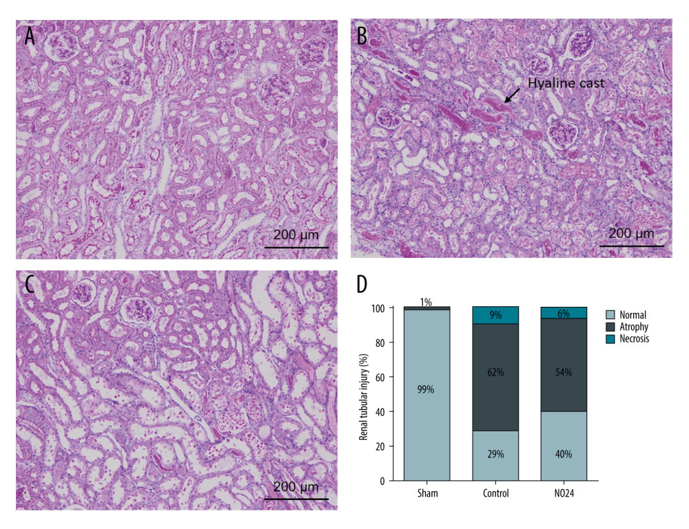 Immunohistochemical analysis of renal morphologyParaffin tissue blocks were prepared for each group by sectioning for immunohistochemical staining. Staining with hematoxylin and eosin and periodic acid-Schiff for renal tissues of (A) sham, (B) control, and (C) NO24 groups (D) and semi-quantitative scoring of tubular damage. Atrophy and necrosis decreased in the NO24 group compared with in the control group. (B) The control group contained many hyaline casts.