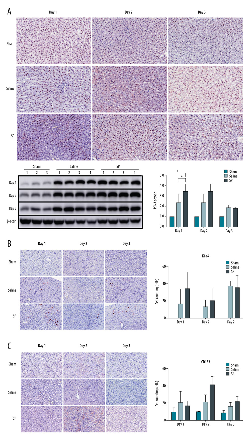 Immunohistochemical analysis of proliferating cell nuclear antigen (PCNA), Ki-67, and CD133 upon substance P (SP) injection after hepatectomy. After hepatectomy, SP was injected on days 1, 2, and 3. Paraffin blocks of tissues from each group were prepared by sectioning and stained using the immunohistochemistry method with PCNA (A), Ki-67 (B), and CD133 (C) antibodies. Prism, version 5 (GraphPad Software, Inc., San Diego, USA) was used for creation of the figure.