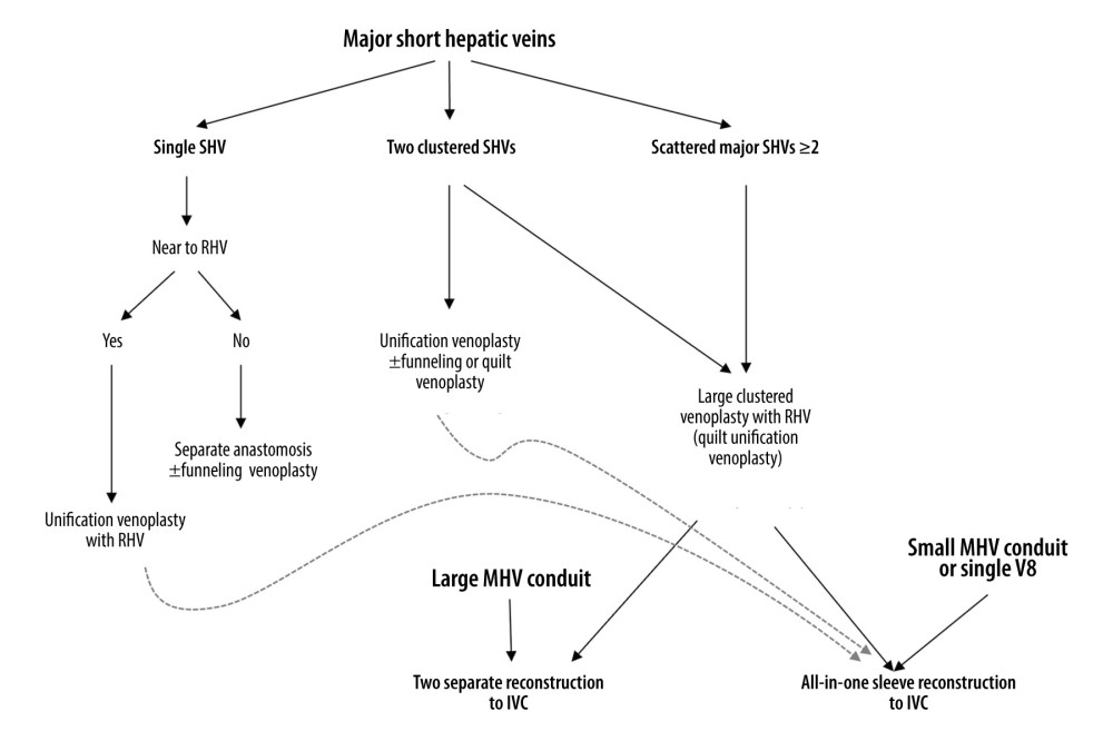 Institutional guidelines for reconstructing 1 or multiple major short hepatic veins (SHVs) with the right hepatic vein (RHV) and middle hepatic vein (MHV). V8 and IVC indicate the segment VIII hepatic vein and the inferior vena cava, respectively.