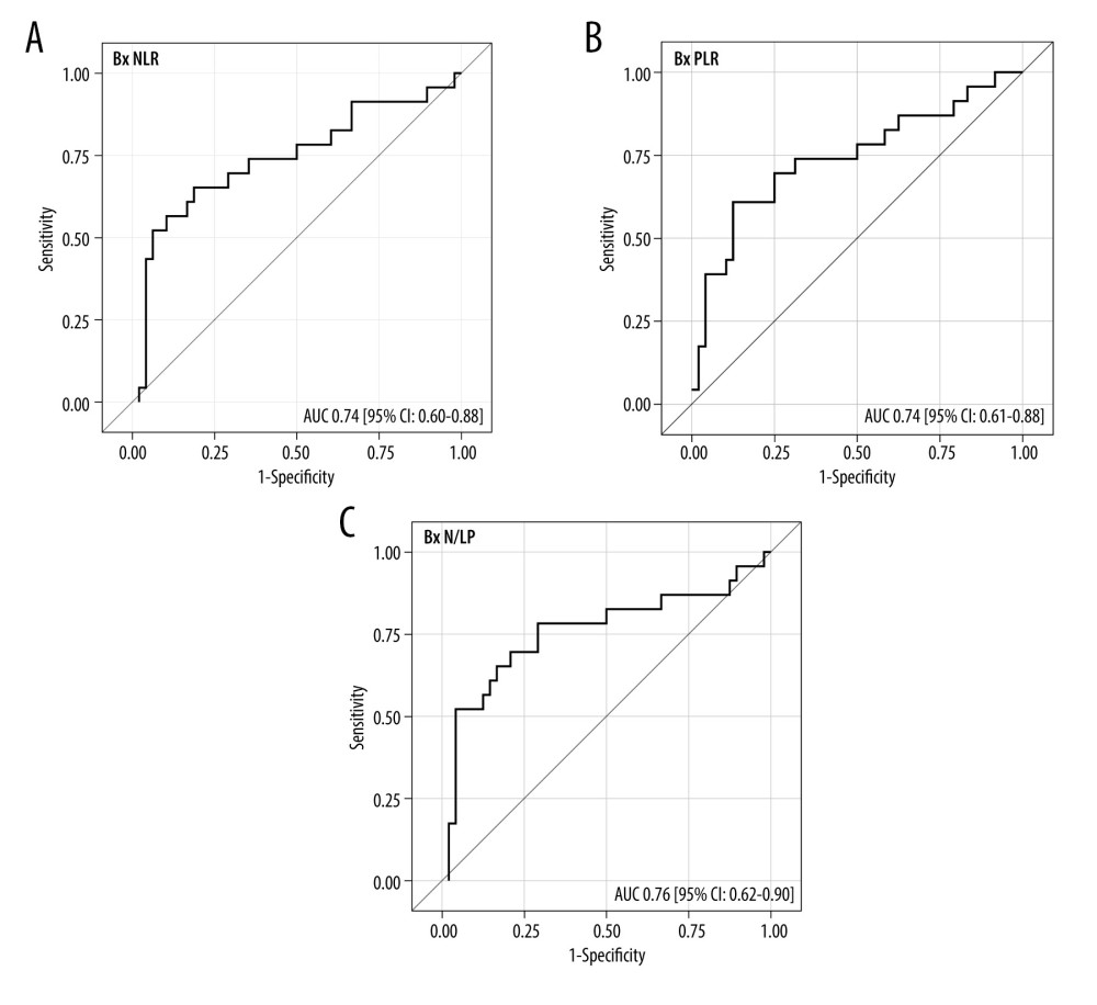 (A–C) The ROC analysis for the values of NLR, PLR, and N/LP ratios calculated at the time of kidney biopsy (Bx), which increased the risk for antibody-mediated rejection. Figure created using STATISTICA 13.3 (Tibco, Inc., Palo Alto, CA, USA).