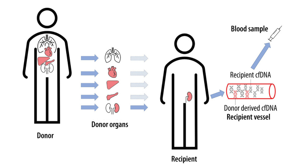 Life-cycle of donor-derived cfDNA from peripheral blood. cfDNA – cell-free DNA (deoxyribonucleic acid).