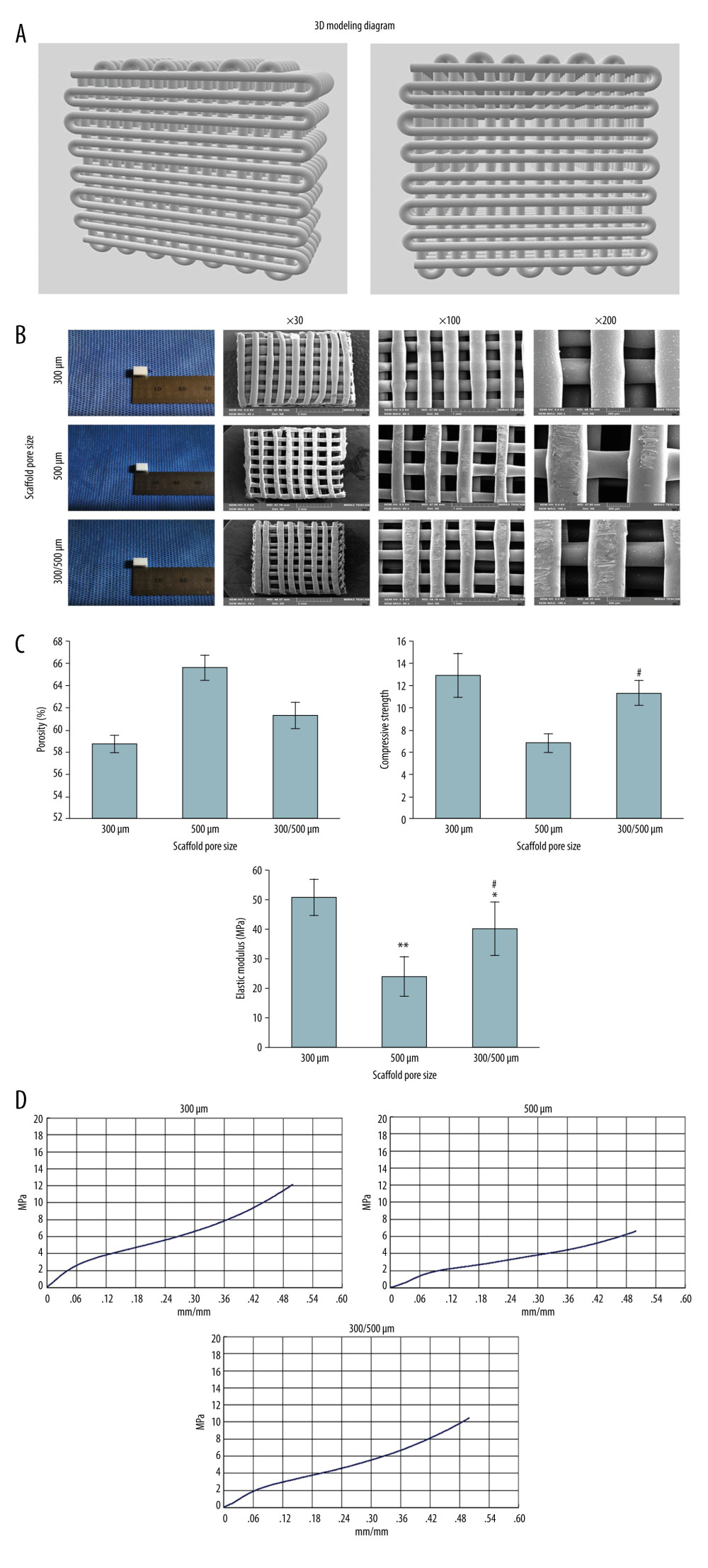 Characterization observation and mechanical property test of scaffolds with different pore sizes (300 μm, 500 μm, 300/500 μm). (A) The 3D modeling diagram of mixed pore size scaffolds. (B) The general appearance of three 3D printed scaffolds with different pore sizes. (C) Porosity, compressive strength, and elastic modulus of 3D printed scaffolds with different pore sizes. ** P<0.01, * P<0.05 versus 300 μm scaffold group, # P<0.05 versus 500 μm scaffold group. (D) The stress-strain curve of 3D printed scaffolds with different pore sizes. Data analysis was carried out using SPSS Statistics version 22.0 (IBM SPSS, Inc., Chicago, IL, USA).