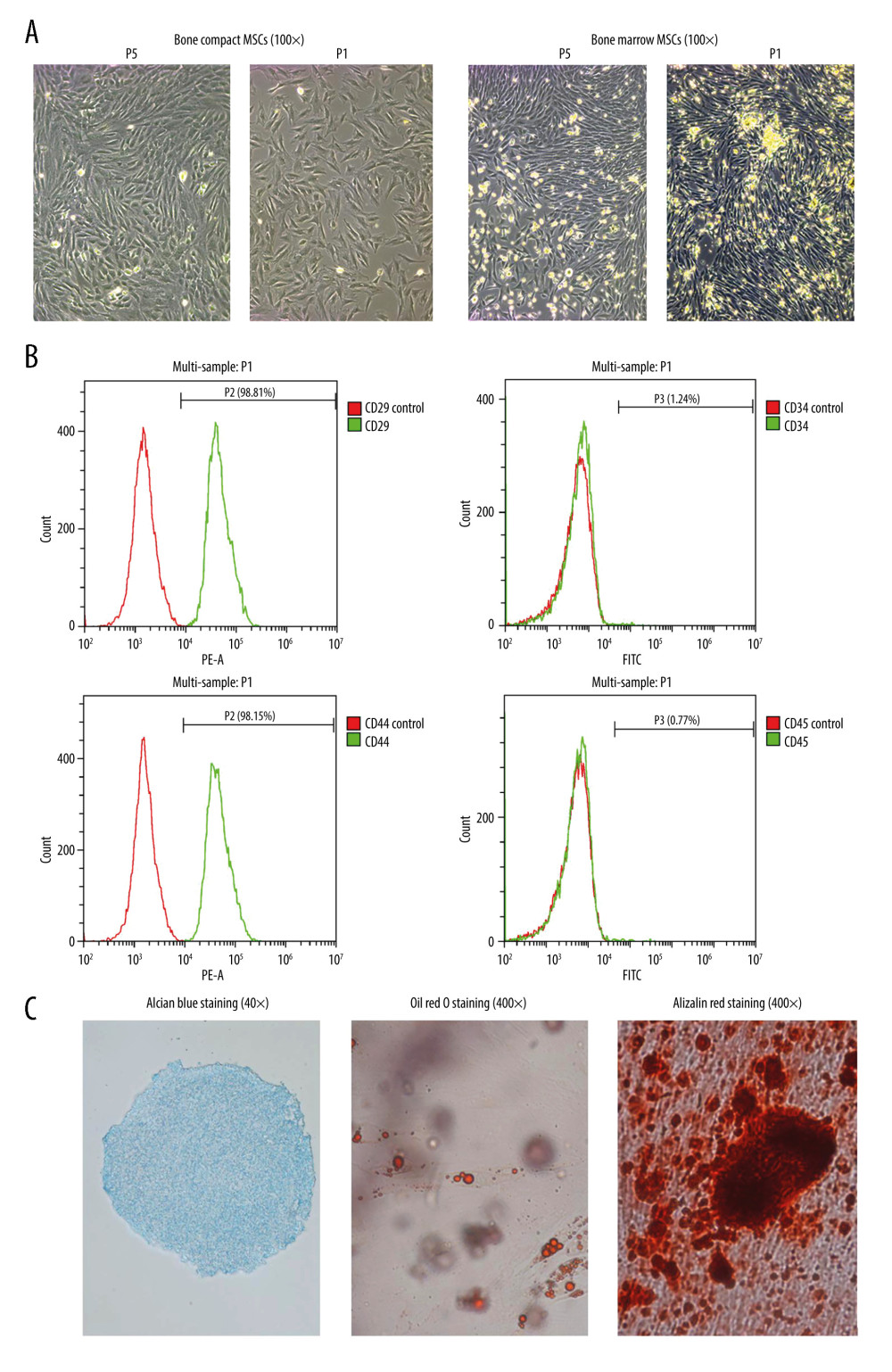 Isolation, culture, and identification of BMSCs-C cells. (A) Morphology of primary bone marrow mesenchymal stem cells (BMSCs) and bone compact mesenchymal stem cells (BMSCs-C) on day 4 (P1) and generation of BMSCs-M and BMSCs-C in P5. (B) Expression of surface biomarkers of BMSCs-C cells (CD29, CD44, CD34, CD45) in P5. (C) Alizarin red staining (Magnification, 400×; red staining) of osteogenic induction, oil red O staining of adipogenic induction (Magnification, 400×; red staining) and Alcian blue staining (Magnification, 400×, blue staining) of chondrogenic induction in BMSCs-C cells. Data analysis was carried out using SPSS Statistics version 22.0 (IBM SPSS, Inc., Chicago, IL, USA).