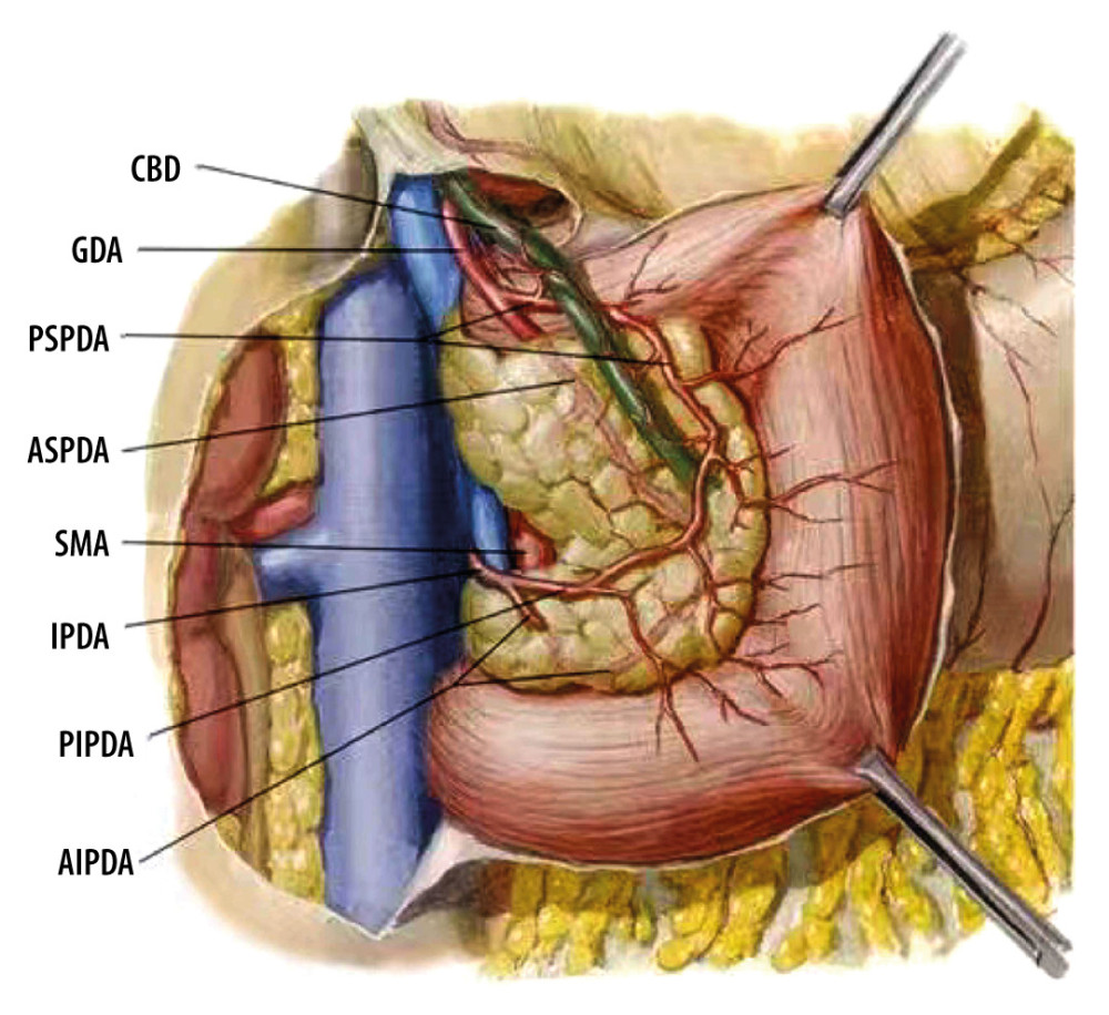 Common bile duct blood supply pattern diagram. The vascular network around the hilar bile originates mainly from the branches of the right hepatic artery and the gallbladder artery, and the bile vessel network below the common hepatic duct is more derived from the gastroduodenal artery and its branches including the anterior superior pancreaticoduodenal artery and posterior superior pancreaticoduodenal artery. CBD – common bile duct; GDA – gastroduodenal artery; PSPDA – posterior superior pancreaticoduodenal artery; ASPDA – anterior superior pancreaticoduodenal artery; SMA – superior mesenteric artery; IPDA – inferior pancreaticoduodenal artery; PIPDA – posterior inferior pancreaticoduodenal artery; AIPDA – anterior inferior pancreaticoduodenal artery.