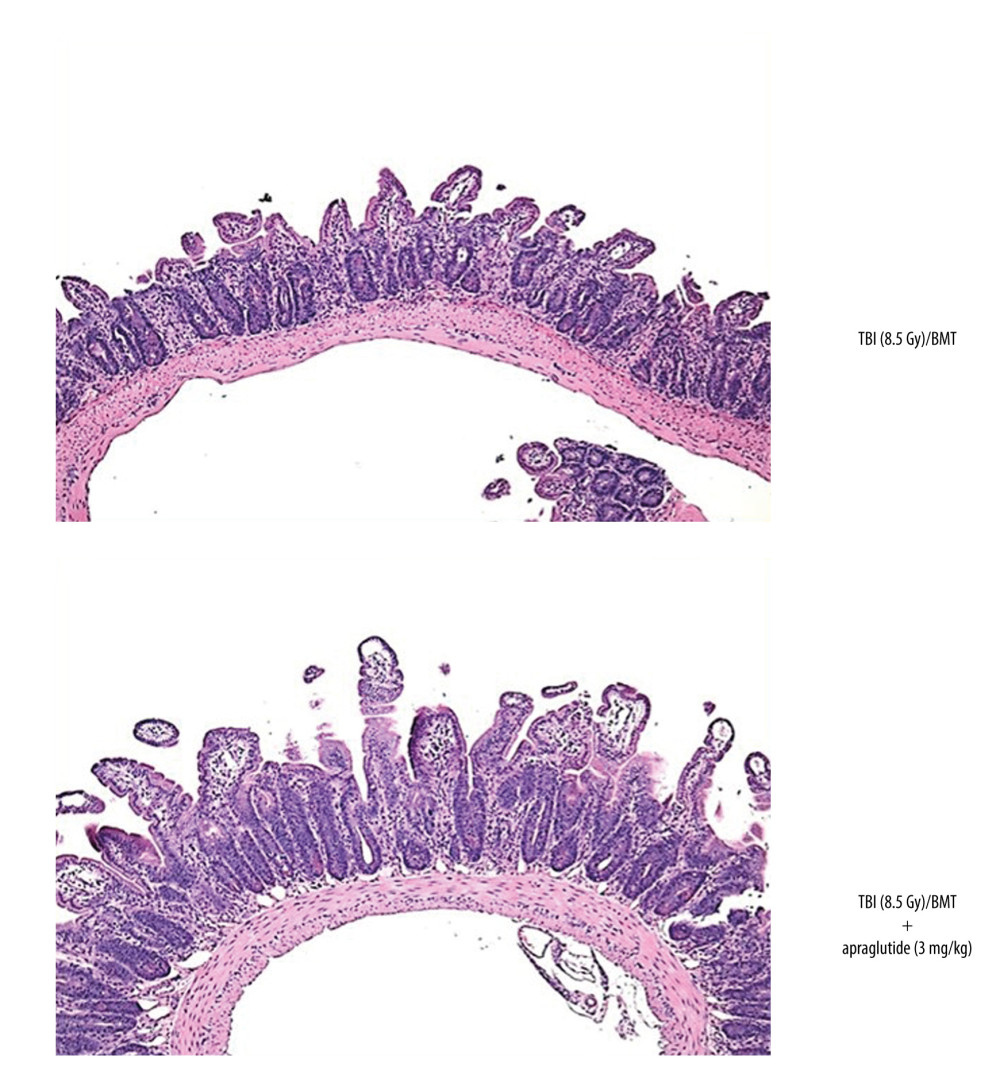 Morphological changes induced by total body irradiation followed by allogenic bone marrow transplantation and protective effect of apraglutide (TBI 8.5 Gy).