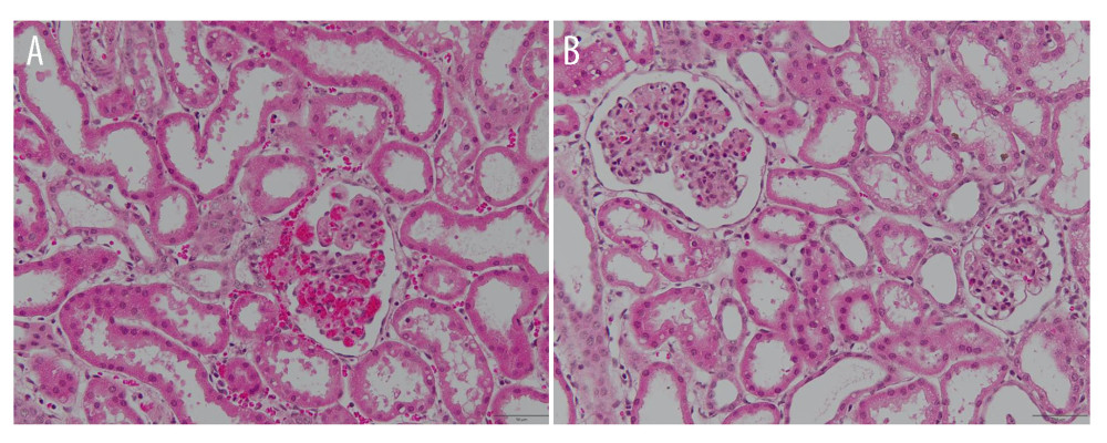 Hematoxylin-eosin staining at the end of reperfusion. (A) Group 1. (B) Group 2.