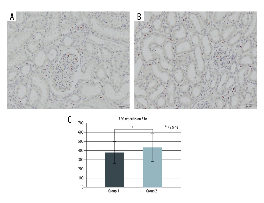 ERG immunohistochemistry at the end of reperfusion. (A) Group 1. (B) Group 2. (C) Quantification of anti-ERG positive area in Groups 1 and 2.