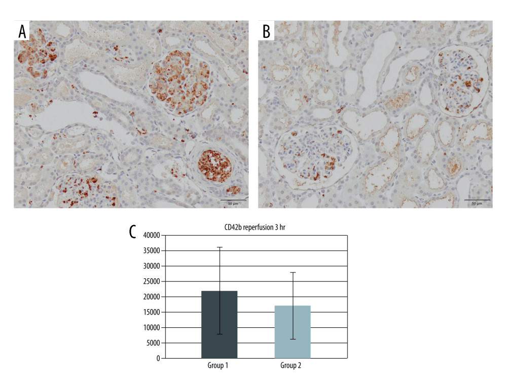 CD42b immunohistochemistry at the end of reperfusion. (A) Group 1. (B) Group 2. (C) Quantification of anti-CD42b positive area in Groups 1 and 2.
