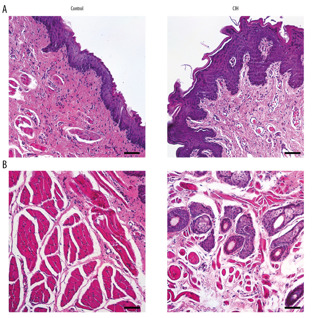 Morphological structure of the soft palate was changed in the CIH exposed rat model. Hematoxylin and eosin staining was performed to identify structure of (A) mucosa and (B) connective tissue in the soft palate of the control group and CIH group. (A) The mucosal layer became thicker when exposed to CIH, and squamous epithelial cells were enlarged and irregularly arranged. (B) Glands widely infiltrated into muscles, and oropharyngeal muscles obviously were destroyed in the CIH-induced soft palate. Scale bar is 100 μm.