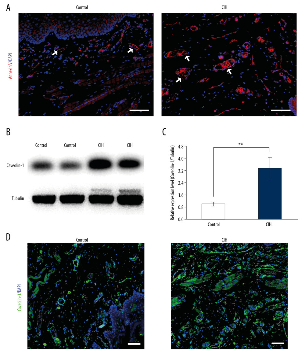 CIH resulted in the dysfunction of vascular endothelial cells. (A) Immunohistochemistry staining of CD31 (red) on the soft palate of the control group and the CIH group. The arrow shows vascular vessels in the connective tissues of the soft palate, and CIH exposure resulted in the enlarged vessels. (B) Western blotting demonstrates the expression of caveolin-1 in the control group and the CIH group. (C) The right bar showing the relative expression level. The relative protein expression was calculated based on the control group which was considered equal to 1. (D) Immunohistochemistry staining for caveolin-1 in the rat soft palate exposed CIH group and the control group. All values presented as mean±standard deviation. ** Significantly different from the control group, P<0.01. Scale bar is 100 μm.