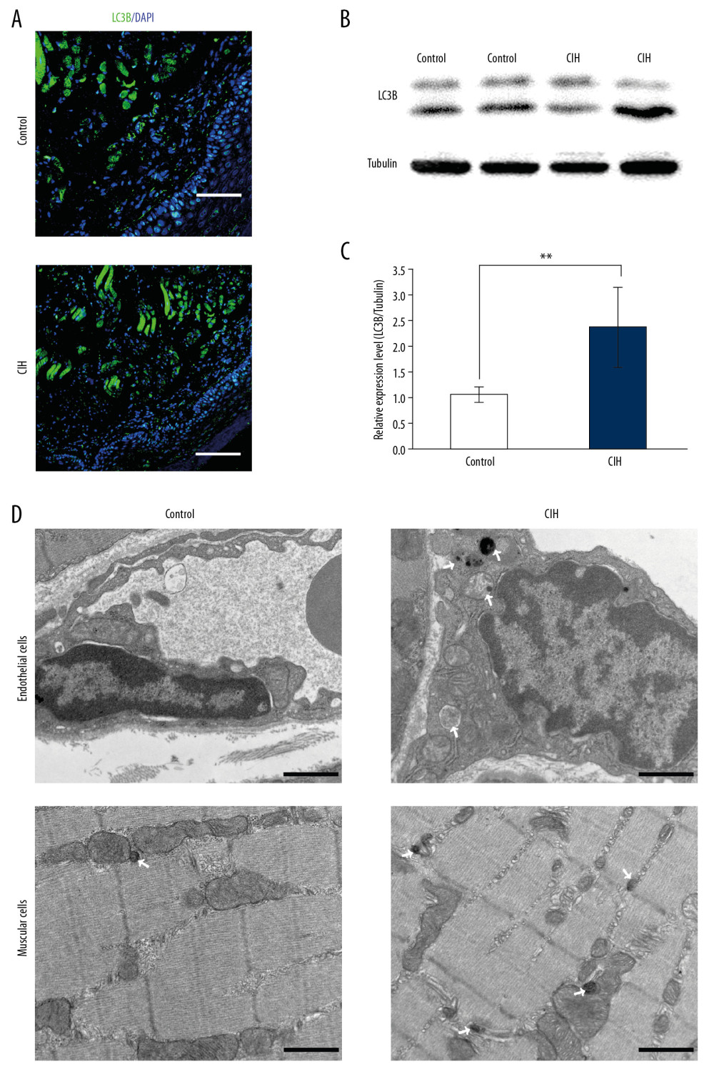 Autophagy was induced to protect CIH-induced dysfunction. (A) Immunohistochemistry staining of LC3B on the soft palate of the control group and the CIH group. The LC3B positive cells were located in the mucosa and muscle layers. Scale bar is 100 μm. (B) Western blotting of LC3B expression in the control group and the CIH group. (C) The bar showing the relative expression level. The relative protein expression was calculated based on the control group which was considered equal to 1. All values are expressed as mean±standard deviation. * P<0.05. (D) Transmission electron microscopy depicting ultras structures of autophagolysosomes in endothelial and muscular cells of the soft plate exposed to normal or chronic intermittent hypoxia. Autophagic vacuoles are highlighted by arrows. Bar scale 1 μm.