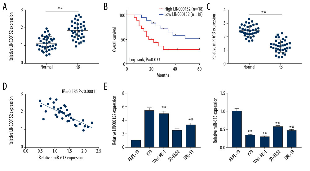 The expression levels of LINC00152 and miR-613 in retinoblastoma tissues and cells. (A) RT-qPCR was used to analyze the expression level of LINC00152 in retinoblastoma tissues and normal retina tissues. (B) The survival curves of retinoblastoma patients were plotted using the Kaplan-Meier method with the log-rank test. (C) The expression level of miR-613 was assessed by RT-qPCR assay in retinoblastoma tissues and normal retina tissues. (D) The correlation relationship between miR-613 and LINC00152 was analyzed. (E) The expression levels of LINC00152 and miR-613 in 4 human retinoblastoma cell lines RBL-13, Y79, Weri-RB-1, and SO-RB50 and human retinal pigment epithelial cell line ARPE-19 were elevated using RT-qPCR assay. ** P<0.01. RT-qPCR – real-time quantitative polymerase chain reaction.
