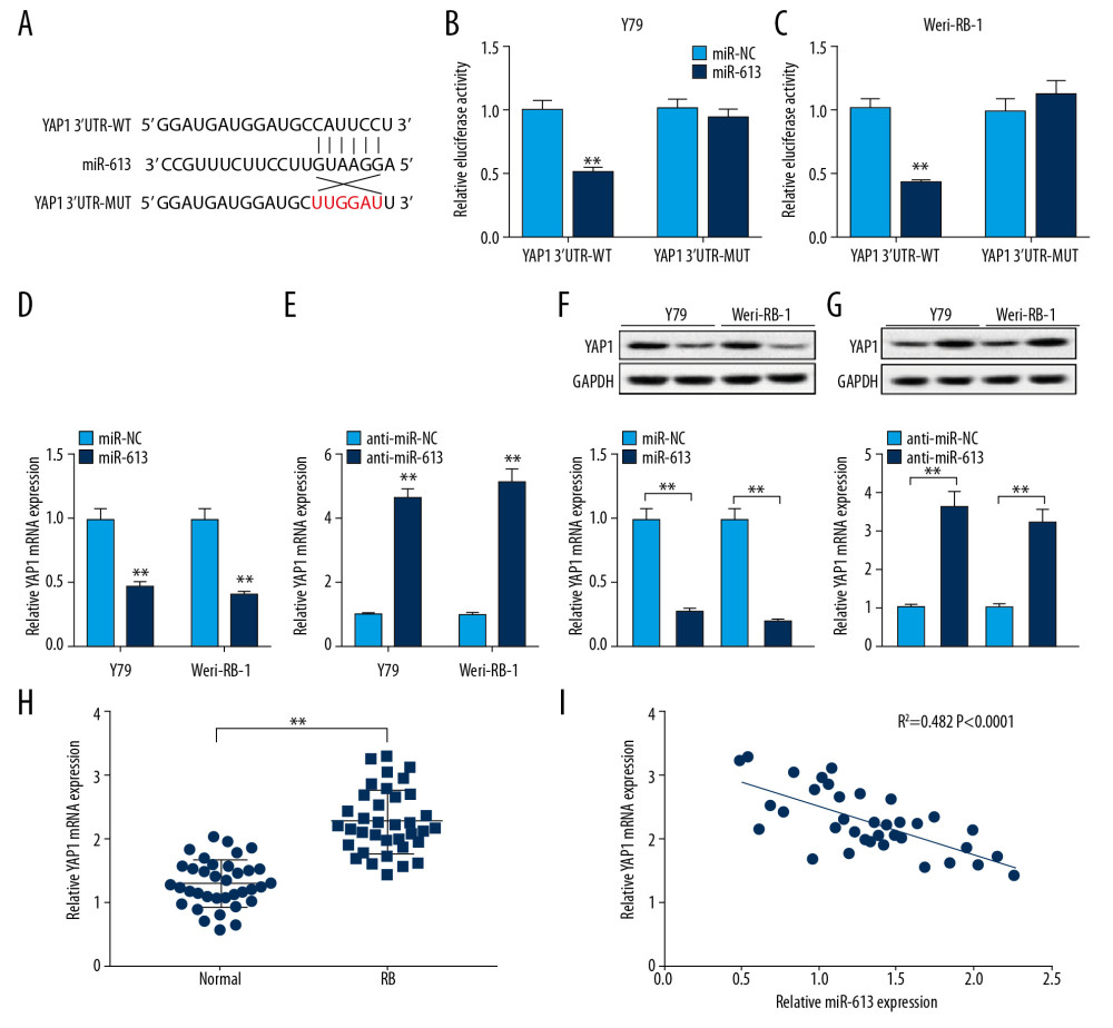 MiR-613 regulated YAP1 expression in retinoblastoma cells. (A) The binding sequences between 3′UTR of YAP1 and miR-613 were predicted by bioinformatics software starBase. (B, C) Dual-luciferase reporter assay was used to assess luciferase activity in Y79 and Weri-RB-1 cells. (D–G) The mRNA and protein expression levels of YAP1 in Y79 and Weri-RB-1 cells introduced with miR-613, miR-NC, anti-miR-613, or anti-miR-NC were measured by RT-qPCR and western blot, respectively. (H) RT-qPCR analysis was used to measure the mRNA expression level of YAP1 in retinoblastoma tissues and normal retina tissues. (I) Correlation analysis between miR-613 and YAP1 was conducted. ** P<0.01. RT-qPCR – real-time quantitative polymerase chain reaction.