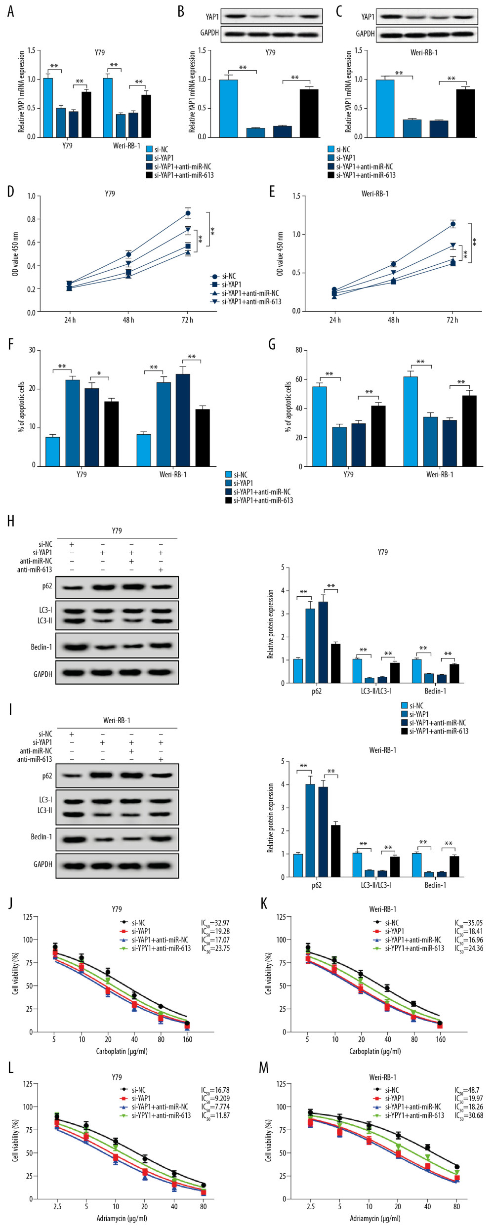MiR-613 regulated proliferation, invasion, autophagy, apoptosis and chemoresistance of retinoblastoma cells by affecting YAP1 expression. (A–M) Y79 and Weri-RB-1 cells were transfected with si-NC, si-YAP1, si-YAP1+anti-miR-NC, or si-YAP1+anti-miR-613. (A–C) The expression levels of YAP1 in transfected Y79 and Weri-RB-1 cells were measured by RT-qPCR and western blot assays. (D, E) Cell viability was evaluated by CCK-8 assay in Y79 and Weri-RB-1 cells after transfection. (F) Cell apoptosis rate was analyzed in Y79 and Weri-RB-1 cells with flow cytometry assay. (G) Transwell assay was performed to assess invasion ability of Y79 and Weri-RB-1 cells post-transfection. (H, I) The protein expression levels of p62, LC3-I, LC3-II and Beclin-1 were determined with western blot assay. (J–M) IC50 value of carboplatin and adriamycin in Y79 and Weri-RB-1 cells was calculated with CCK-8 assay. ** P<0.01. RT-qPCR – real-time quantitative polymerase chain reaction; CCK-8 – Cell Counting Kit-8.