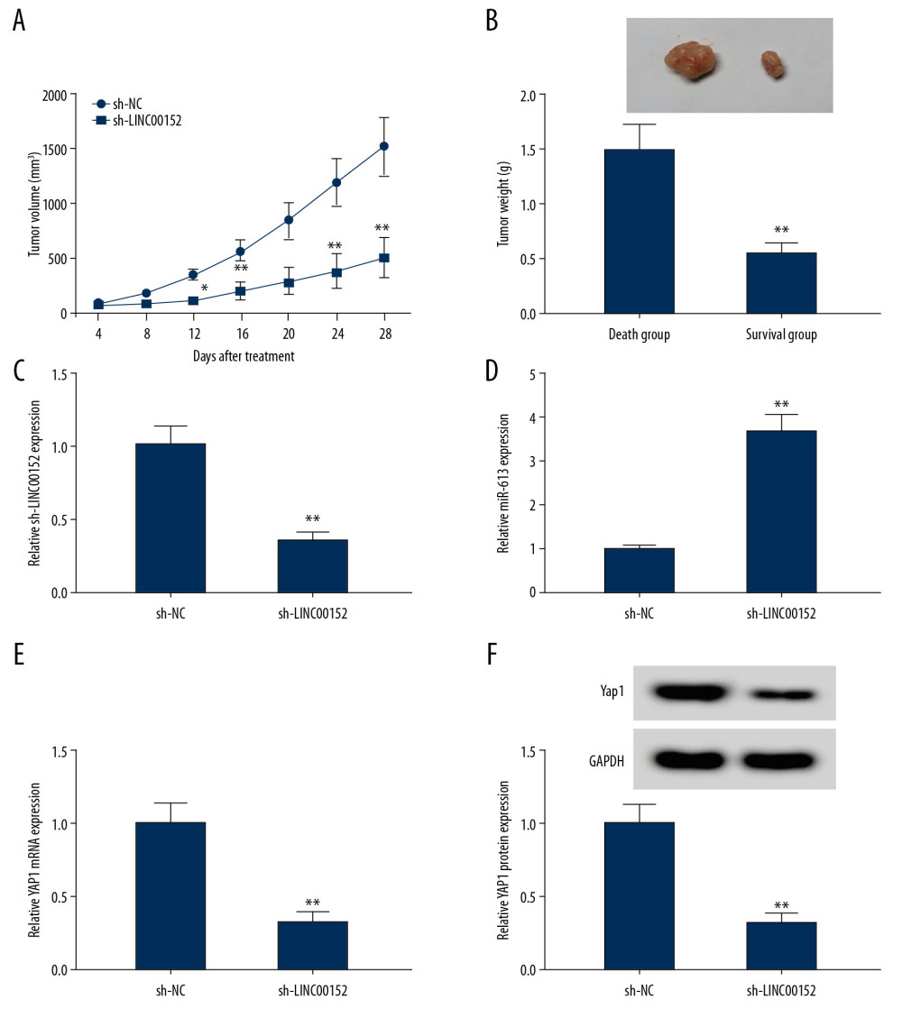 Shortage of LINC00152 impeded tumor growth in vivo. (A, B) The volume and weight of tumor were displayed. (C–E) The mRNA expression levels of LINC00152, miR-613, and YAP1 in dissected tumor tissues were estimated with RT-qPCR assay. (F) Western blot assay was used to assess protein level of YAP1 in removed tumor tissues. * P<0.05; ** P<0.01. RT-qPCR – real-time quantitative polymerase chain reaction.