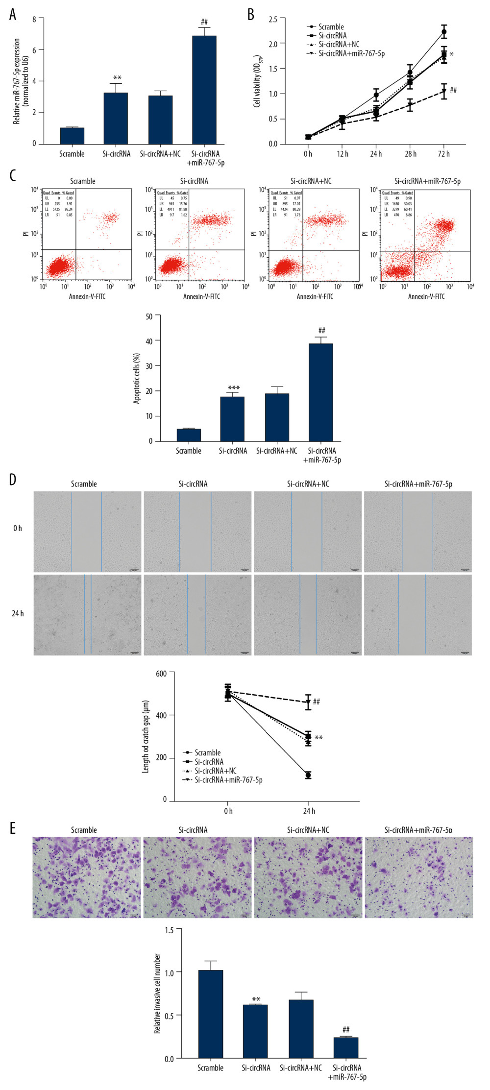miR-767-5p transfection enhanced the inhibitory impacts of circ_0005556 knockdown on GC cells. (A) Expression of miR-767-5p was analyzed by qRT-PCR in GC cells transfected with si-circ_0005556 or miR-767-5p (** P<0.01 vs. scrambled group, ## P<0.01 vs. si-circRNA+NC group). (B) GC cell viability, (C) apoptosis, (D) migration, and (E) invasion were estimated by MTT, flow cytometry, wound-healing, and transwell assays, respectively, after transfection with si-circ_0005556 or miR-767-5p (** P<0.01 vs. scrambled group, ## P<0.01 vs. si-circRNA+NC group).