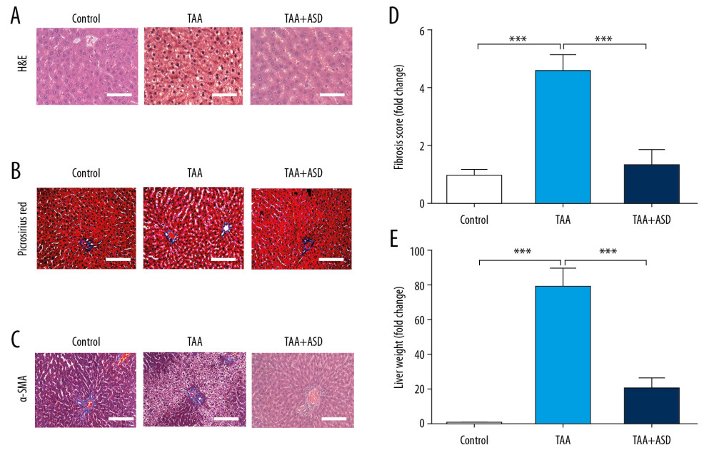 ASD reversed TAA-induced liver injury and fibrogenesis in liver injury model rats. (A) Images showing the effect of TAA alone or with ASD on the liver morphohistology in the liver injury model rats. Images of the effect of TAA alone or with ASD on the (B) picrosirius red-stained collagen fibers, and (C) α-SMA expression. Graphs showing how TAA alone or with ASD affected the (D) fibrosis score and (E) collagen area in the liver injury model rats. *** p<0.001.
