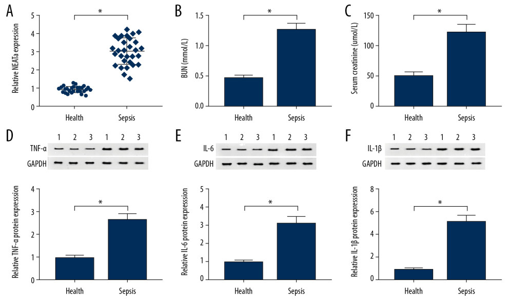 The expression level of NEAT1 in sepsis patients and healthy volunteers. (A) The relative expression level of NEAT1 in kidney tissues from sepsis patients and healthy kidney tissues was assessed with RT-qPCR assay. (B, C) BUN and serum creatinine were analyzed in kidney tissues from sepsis patients. (D–F) Western blot analysis was used to detect TNF-α, IL-6, and IL-1β levels in sepsis patients and healthy kidney tissues. * P<0.05.