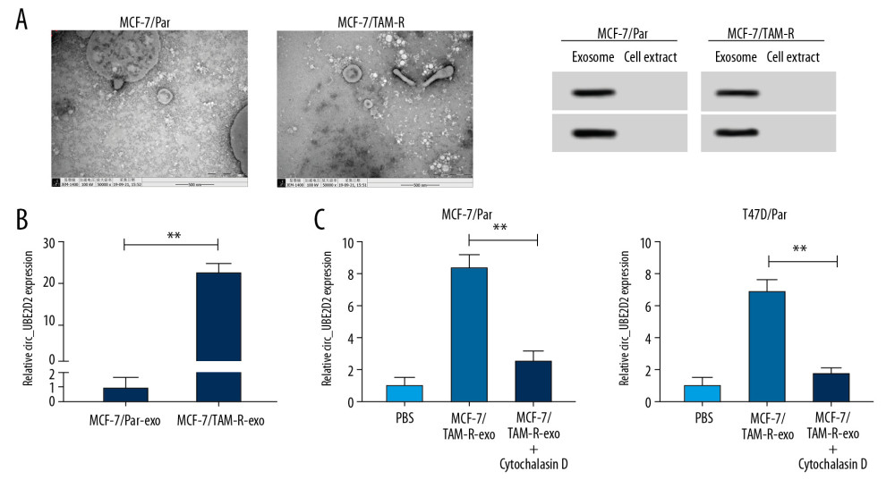 Upregulation of circ_UBE2D2 in exosomes from tamoxifen-resistant breast cancer cells. Cell exosomes were extracted from tamoxifen-resistant and parental breast cancer cells. (A) The image of exosomes was captured by TEM, and the expression levels of exosomal markers CD9 and CD63 were measured by western blot. (B) Circ_UBE2D2 expression in MCF-7/TAM-R-exo and MCF-7/Par-exo was detected by qRT-PCR. (C) qRT-PCR analysis of circ_UBE2D2 was conducted in the MCF-7/TAM-R-exo co-cultured parental cells untreated with or treated with cytochalasin D. * P<0.05, ** P<0.01. TEM – transmission electron microscopy; qRT-PCR – real-time polymerase chain reaction.