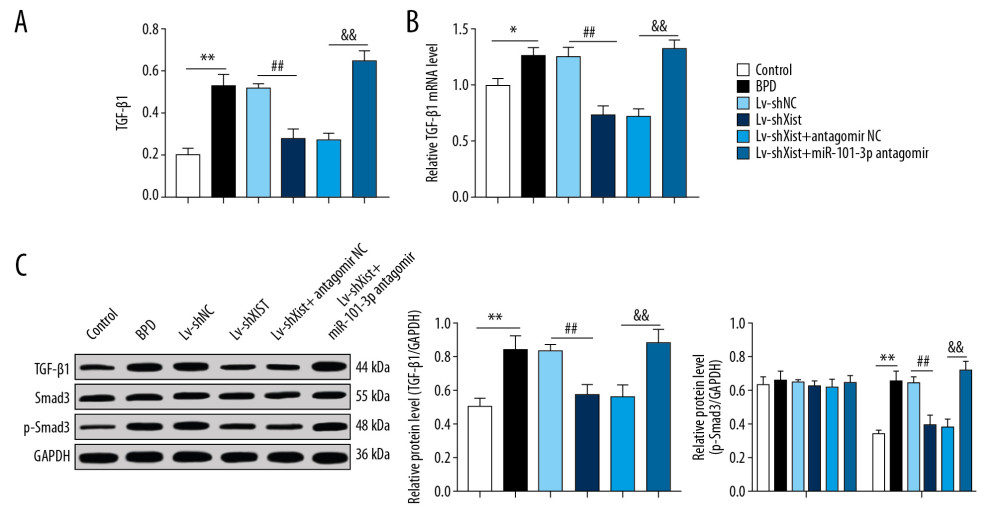 Silenced Xist competitively combines with miR-101-3p to suppress HMGB3 and negatively regulates the TGF-β1/Smad3 axis. (A) ELISA found that the high protein level of TGF-β1 in BPD mice was reduced with silenced Xist. (B) RT-qPCR showed that the highly expressed mRNA of TGF-β1 in lung tissues of newborn BPD mice were inhibited after silencing Xist. (C) Western blot analysis suggested that the high protein level of TGF-β1 and Smad3 phosphorylation in lung tissues of BPD mice were inhibited after silencing Xist. One-way ANOVA was performed to determine data in panels A–C, and two-way ANOVA was performed to determine data in panel D, Tukey’s multiple comparisons test was applied for post hoc test. * p<0.01, ** p<0.01, ## p<0.01, && p<0.01, n=3. Xist – X inactive specific transcript; miR – microRNA; HMGB3 – high-mobility group protein B3; TGF-β1 – transforming growth factor-beta 1; Smad3 – drosophila mothers against decapentaplegic 3; ELISA – enzyme-linked immunosorbent assay; BPD – bronchopulmonary dysplasia; RT-qPCR – reverse transcription-quantitative polymerase chain reaction; ANOVA – analysis of variance.
