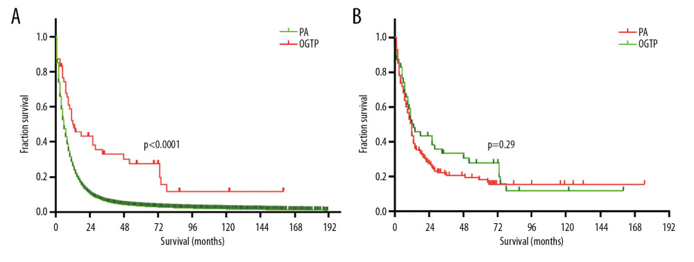 (A) Kaplan Meier curves suggested that OGTP patients had significantly longer survival than PA patients before PSM (13 months versus 6 months; HR 0.55, 95% CI 0.37–0.57, P<0.0001). (B) Kaplan-Meier survival curves demonstrating no significant extension in survival for OGTP patients relative to PA patients after PSM (13 months versus 12 months; HR 0.92, 95% CI 0.63–1.34, P>0.05). OGTP – osteoclast-like giant cell tumor of the pancreas; PA – pancreatic adenocarcinoma; PSM – propensity score matching; HR – hazard ratio; CI – confidence interval.