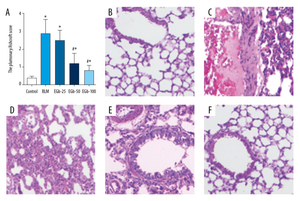 EGb761 suppresses pulmonary inflammation induced by bleomycin (BLM) in mice. (A) Pulmonary inflammation of mice was evaluated by lung alveolitis score after treatment with BLM for 28 days. Lung tissues from normal mice (B), BLM-treated group (C), low-dose EGb761 group (D), mild-dose EGb761 group (E), and high-dose EGb761 group (F) were stained with hematoxylin and eosin; magnifications were 200×. All data are shown as mean±standard deviation (n=5). * P<0.05 vs. normal group; # P<0.05 vs. BLM group.