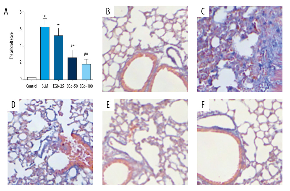 EGb761 protects mice from pulmonary fibrosis induced by bleomycin (BLM). (A) Protective effects of EGb761 on lung fibrosis induced by BLM were evaluated by Ashcroft score. Lung tissues from normal mice (B), BLM-treated group (C), low-dose EGb761 group (D), mild-dose EGb761 group (E), and high-dose EGb761 group (F) were stained with Masson stain; magnifications were 200×. All data are shown as mean±standard deviation (n=5). * P<0.05 vs. normal group; # P<0.05 vs. BLM group.