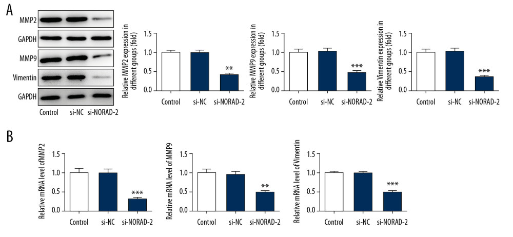 NORAD silencing reduced the expression of migration-related genes in glioma cells. The MMP2, MMP9, and vimentin (A) protein and (B) mRNA expression was detected using western blotting and RT-qPCR, respectively. All experiments were repeated 3 times independently (n=3). ** P<0.01, *** P<0.001 versus si-NC. NORAD – noncoding RNA activated by DNA damage; mRNA – messenger RNA; RT-qPCR – reverse transcription-quantitative polymerase chain reaction; si-NC – negative control for NORAD siRNA.