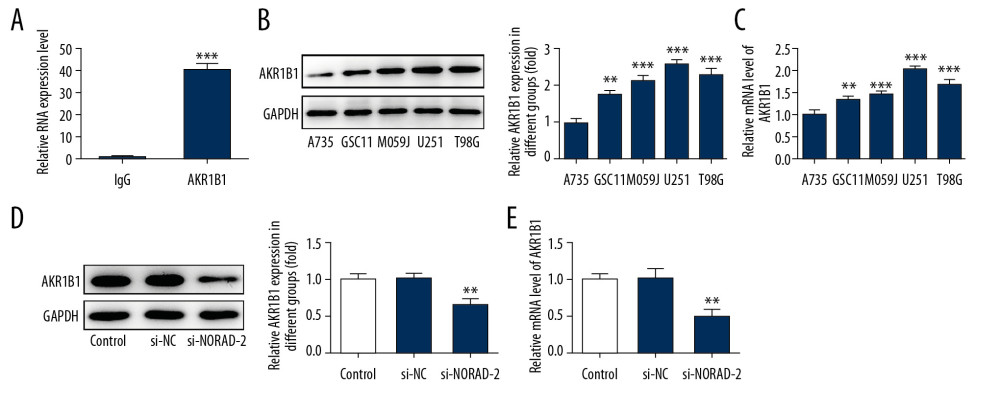 AKR1B1 interacted with NORAD. (A) The interplay between NORAD and AKR1B1 was detected by RIP assay. The expression of AKR1B1 in glioma cell lines (GSC11, M059J, U251, and T98G) was measured by (B) western blotting and (C) RT-qPCR, respectively. Three independent experiments were carried out (n=3). ** P<0.01, *** P<0.001 versus A735. The level of AKR1B1 in U251 cells was examined using (D) western blotting and (E) RT-qPCR after transfection with si-NORAD-2. All experiments were repeated 3 times independently (n=3). ** P<0.01 versus si-NC. NORAD – noncoding RNA activated by DNA damage; RIP – RNA-binding protein immunoprecipitation; RT-qPCR – reverse transcription-quantitative polymerase chain reaction; si-NORAD – small interfering RNAs (siRNAs) against NORAD; si-NC – negative control for NORAD siRNA.